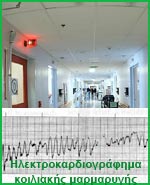 Σε ευαίσθητους ασθενείς το στρες μπορεί να είναι η αιτία καρδιακής ανακοπής